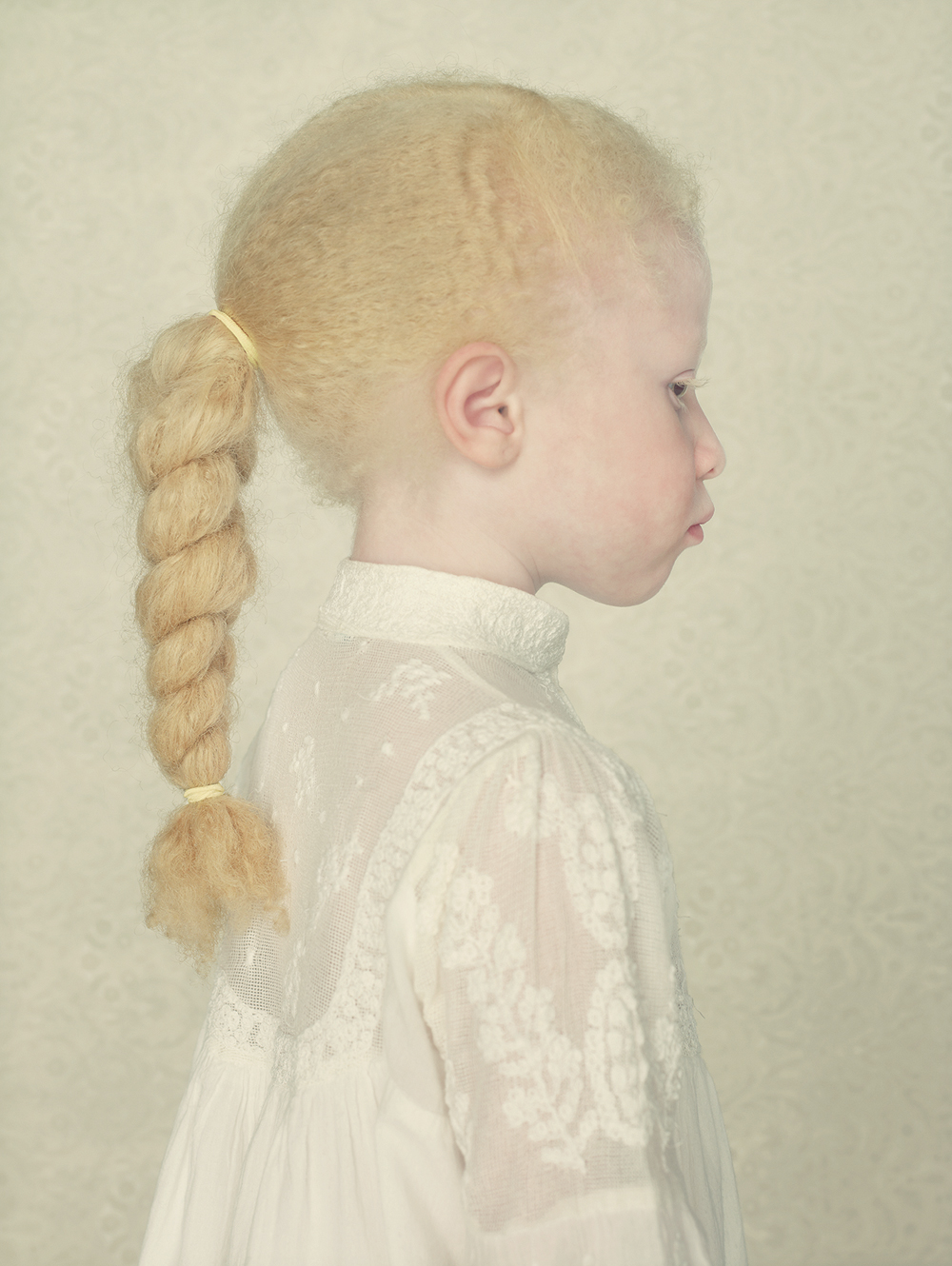 Elemento Latente - Albinos