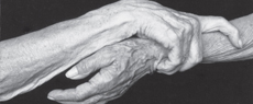O Desafio da longevidade e o suporte ao cuidador